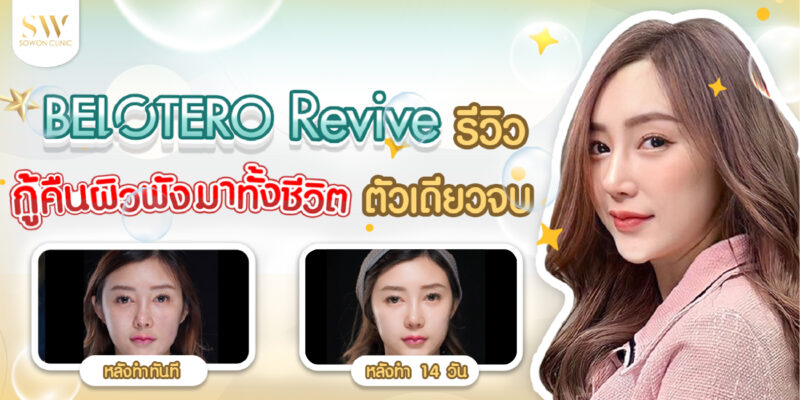Belotero Revive รีวิว