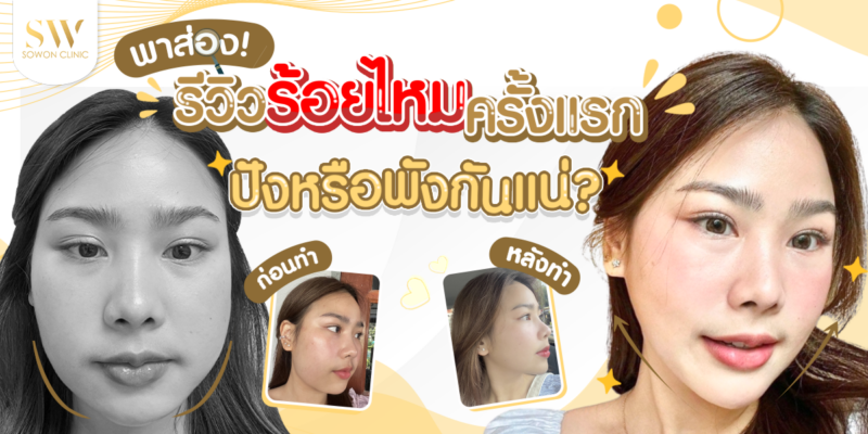 รีวิวร้อยไหม