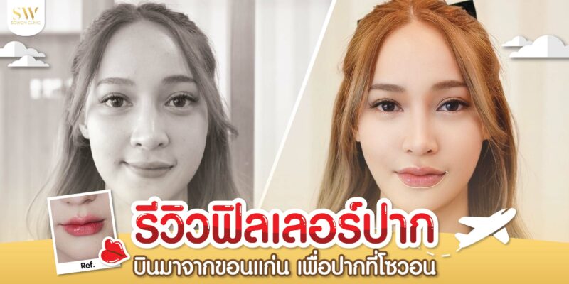 รีวิวฟิลเลอร์ปาก