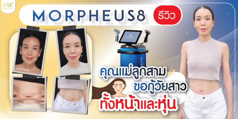 Morpheus8รีวิว