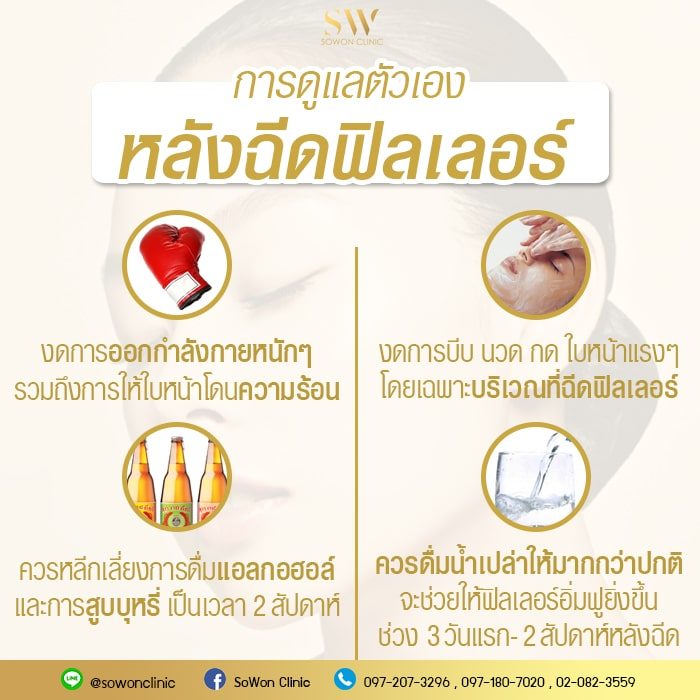 ฟิลเลอร์ปาก