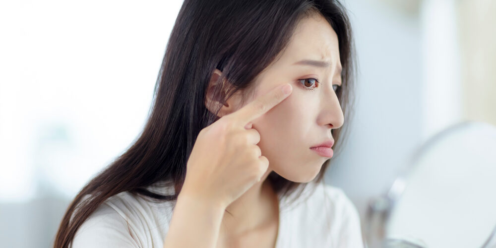 Young,Woman,Looking,At,Mirror,And,Checking,The,Crow’s,Feet ผู้หญิงกังวลเรื่องริ้วรอยหางตาเวลายิ้ม