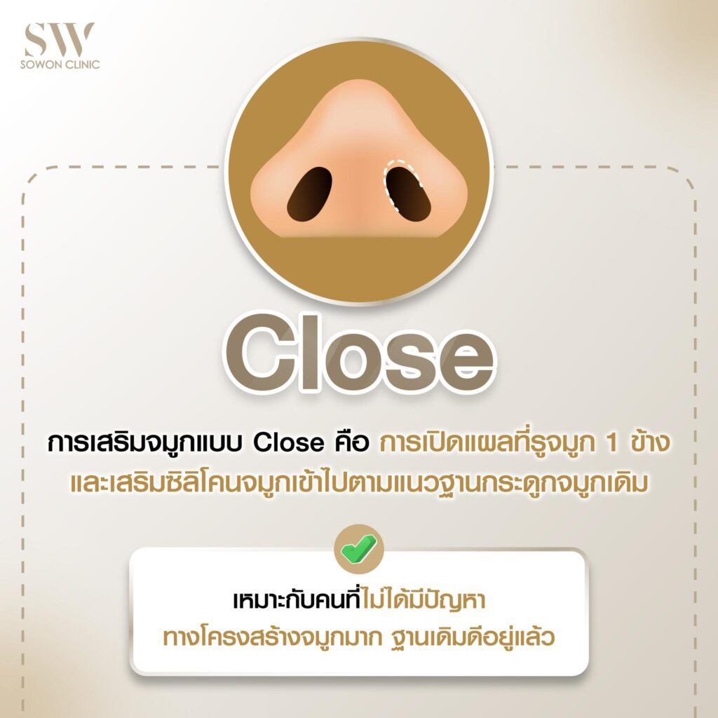 หมอกอล์ฟ Value01
