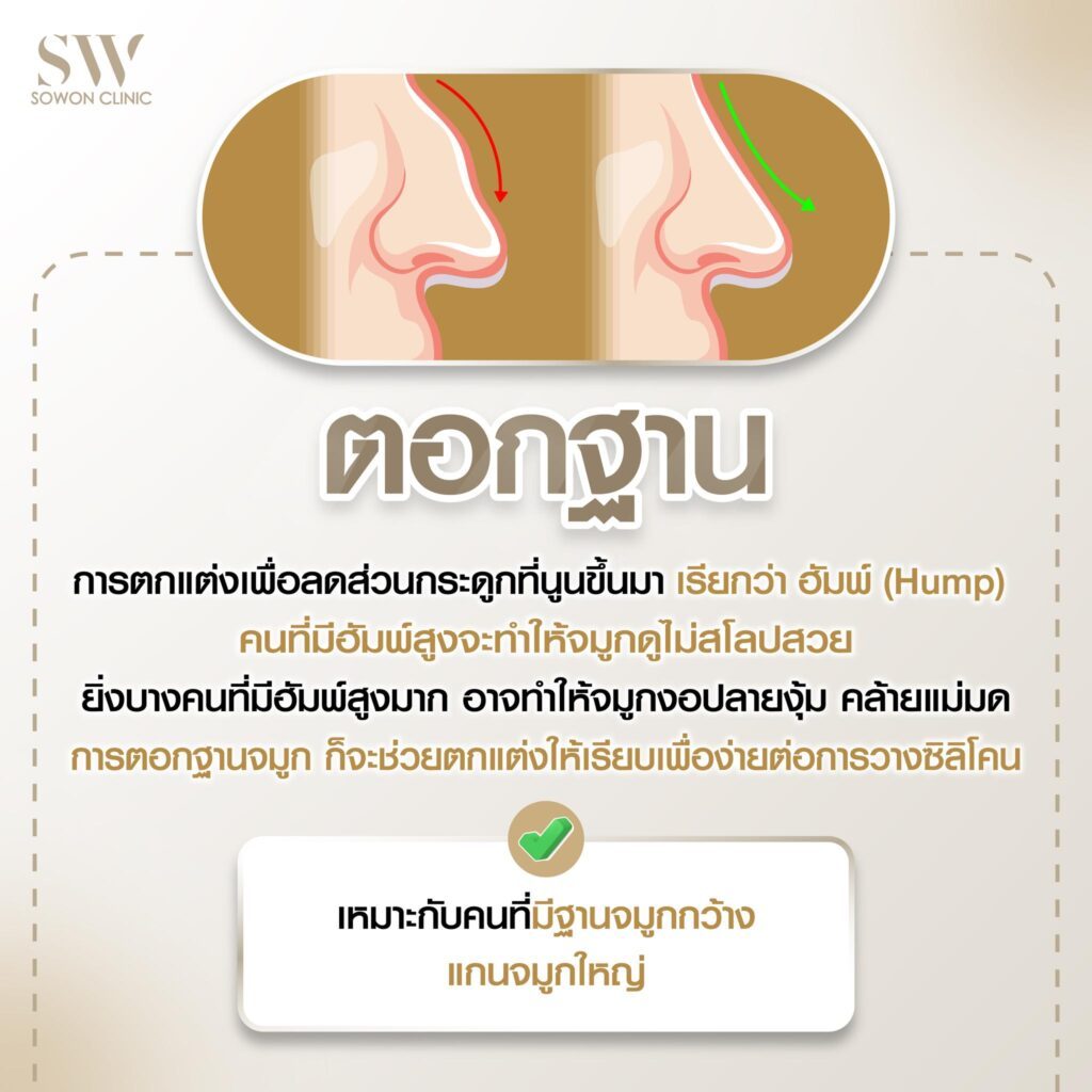หมอกอล์ฟ Value04