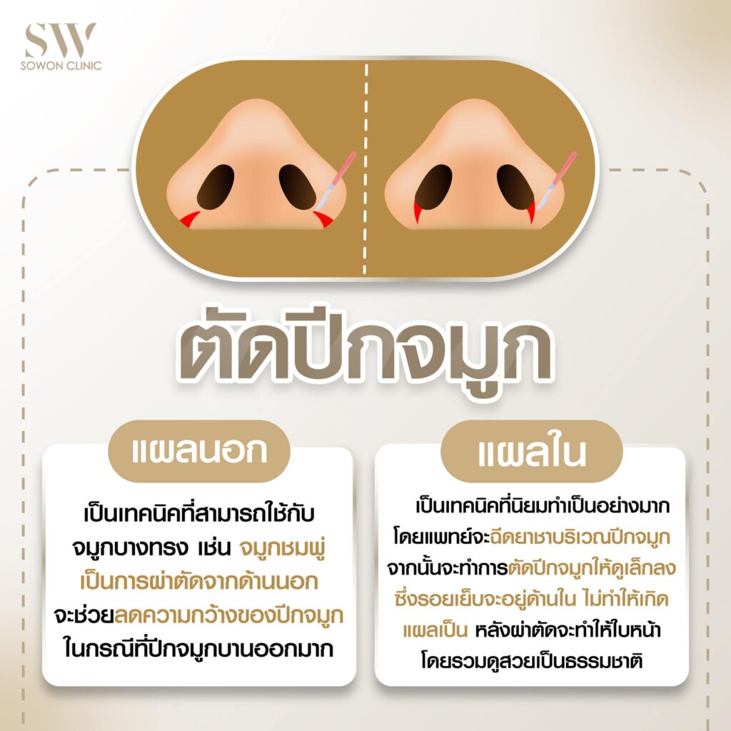 หมอกอล์ฟ Value06