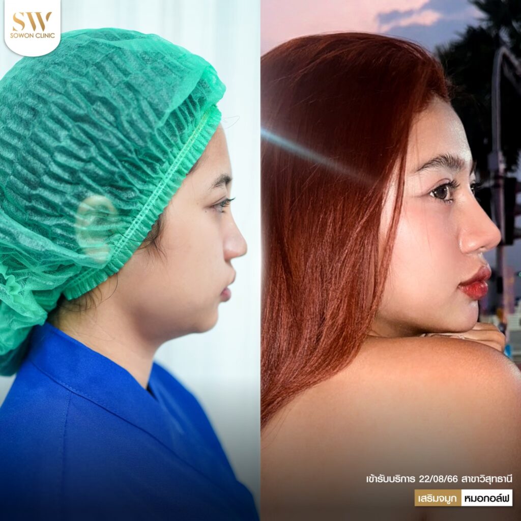 หมอกอล์ฟรีวิว04