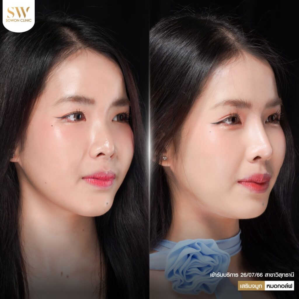 หมอกอล์ฟรีวิว05