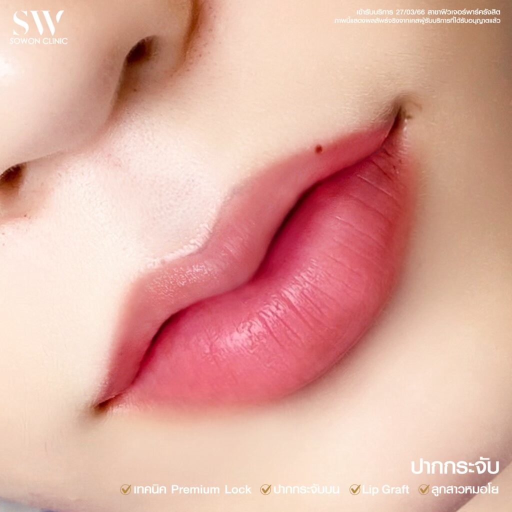 ปากหมอโย 2
