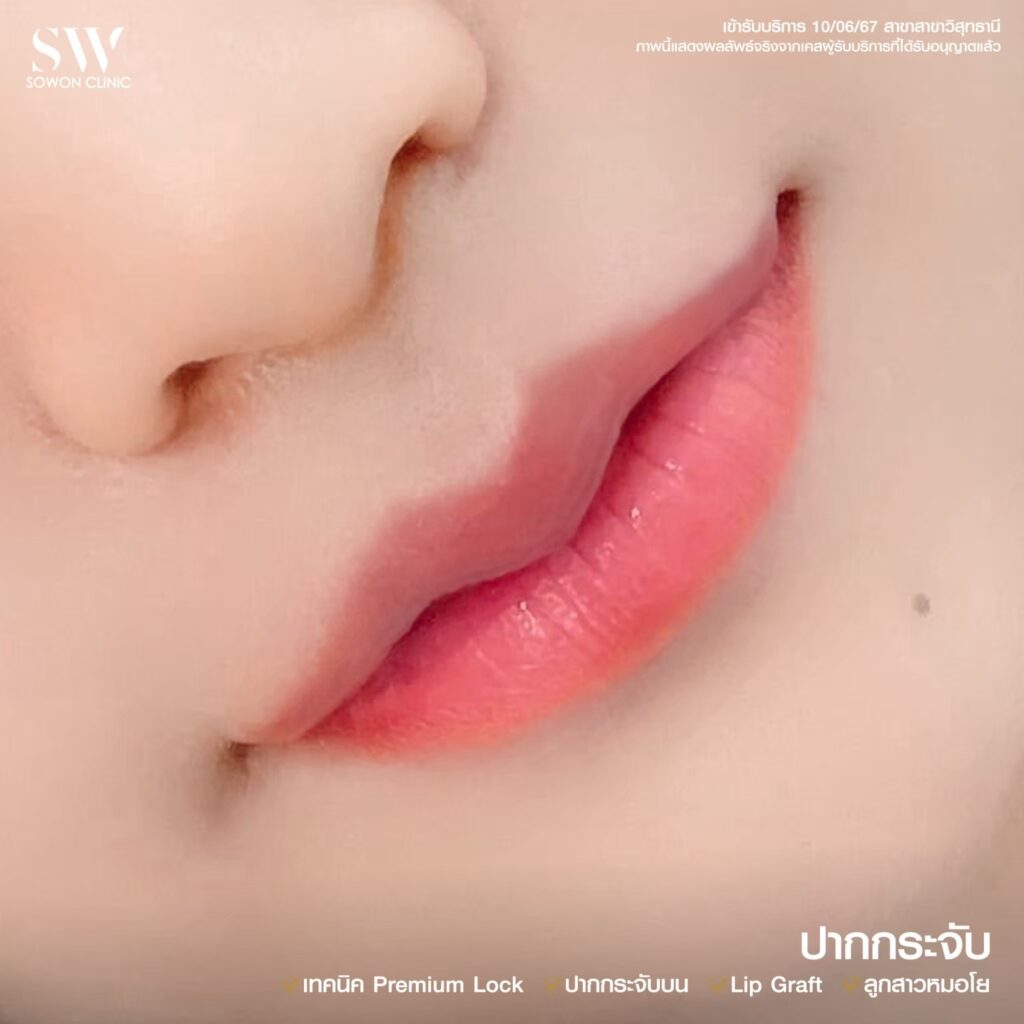 ปากหมอโย 3