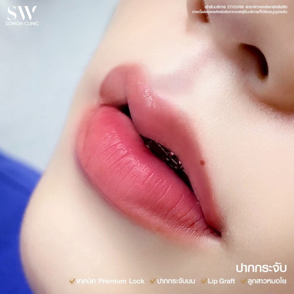 ปากหมอโย 5