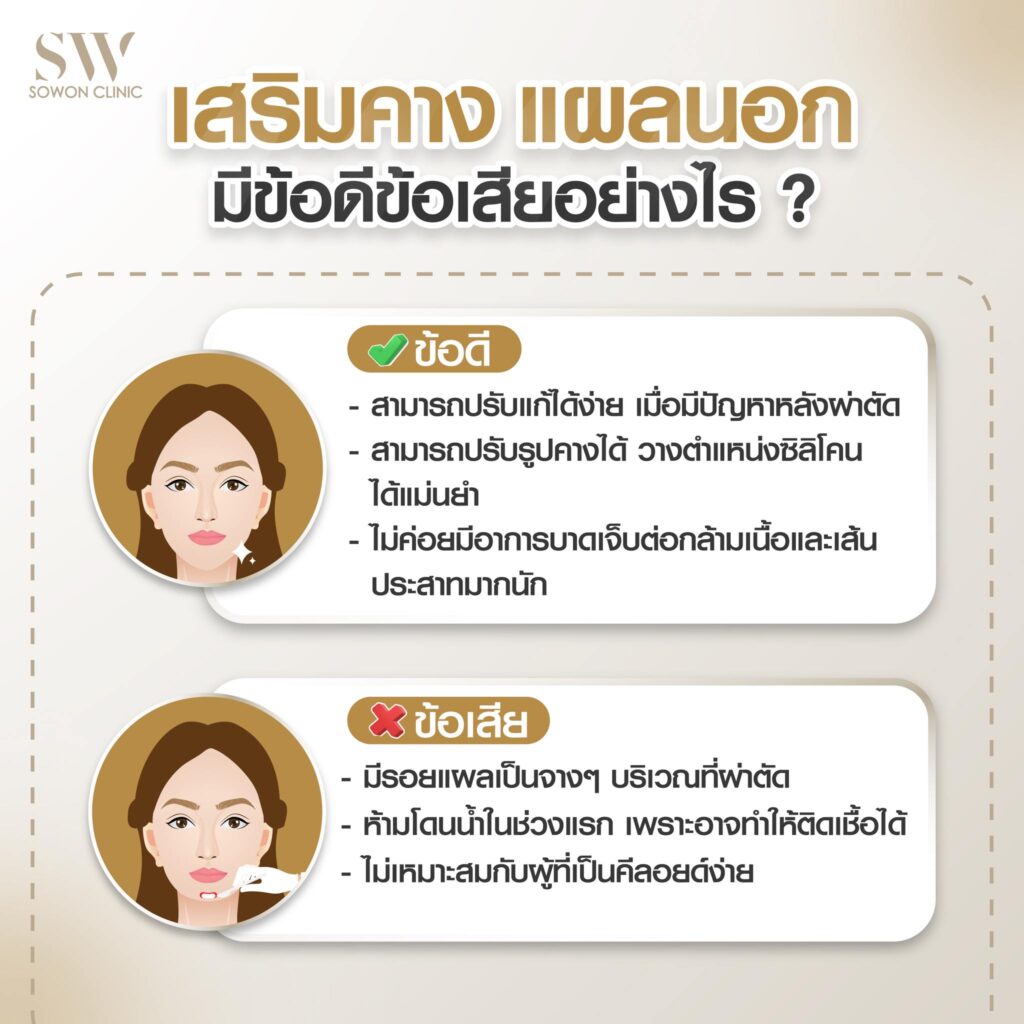 เสริมคางหมอแพน2