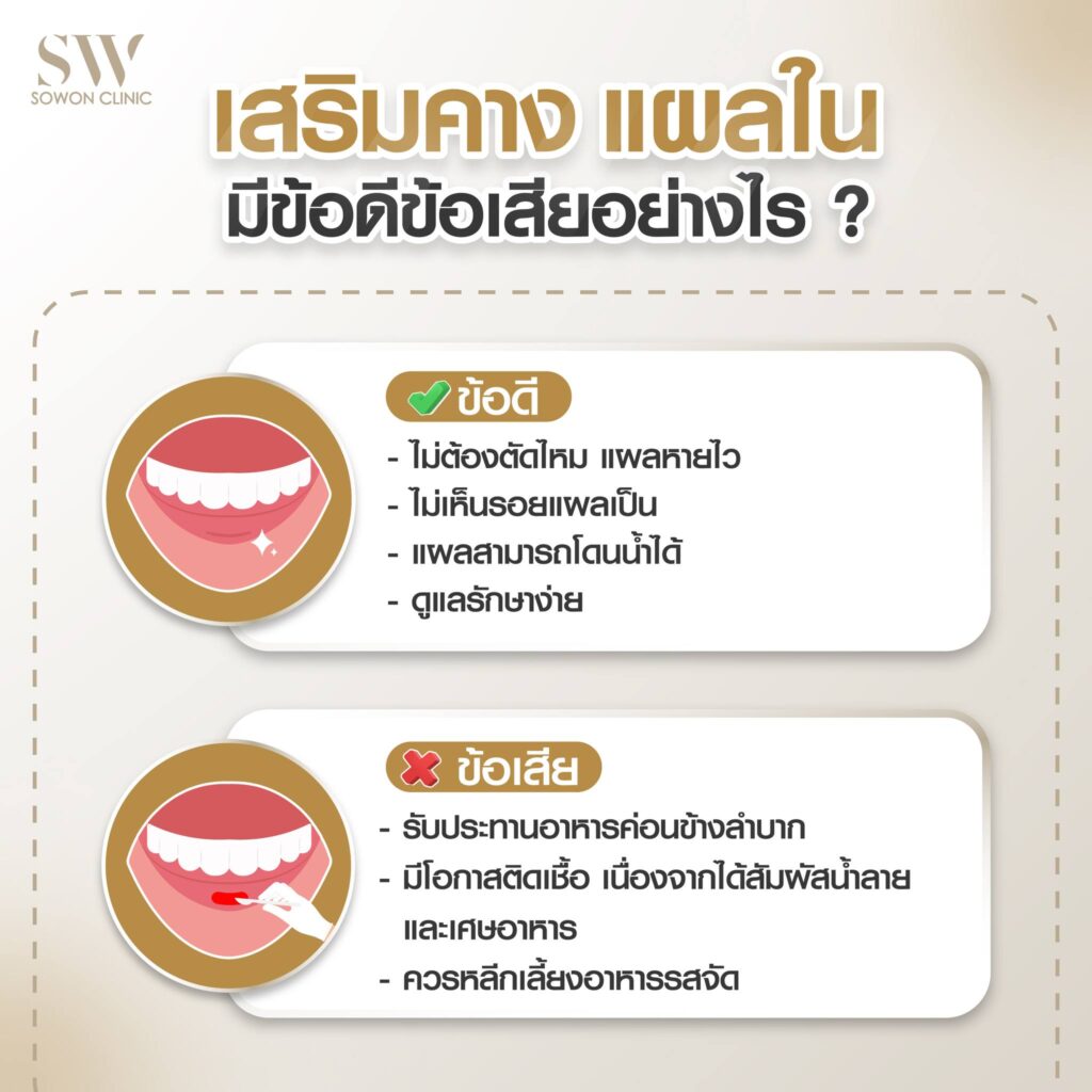 เสริมคางหมอแพน3