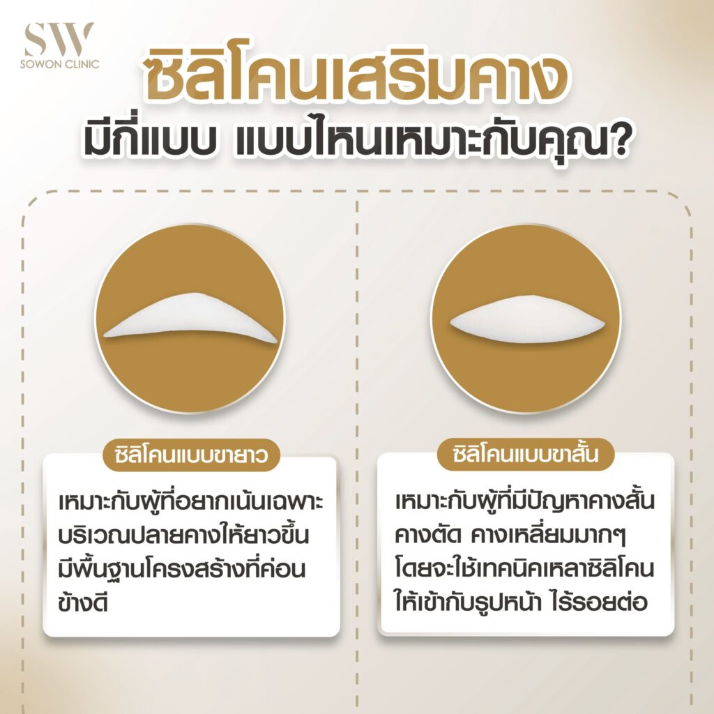 เสริมคางหมอแพน4