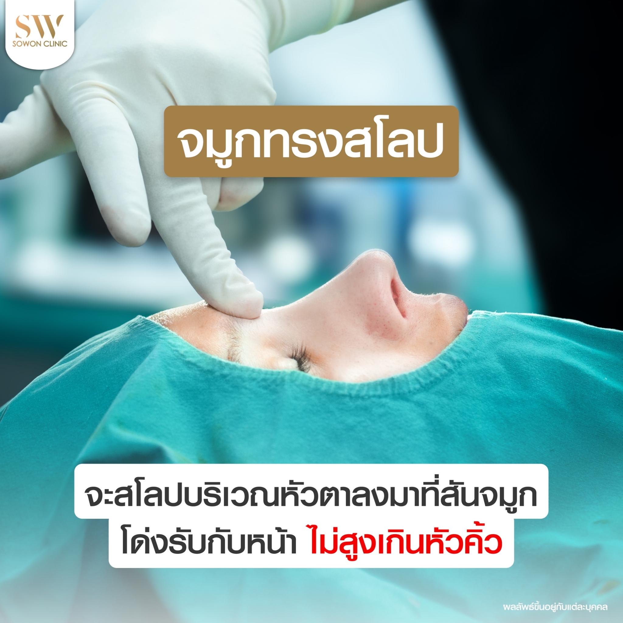 จมูกสโลปหวานปลายพุ่ง02