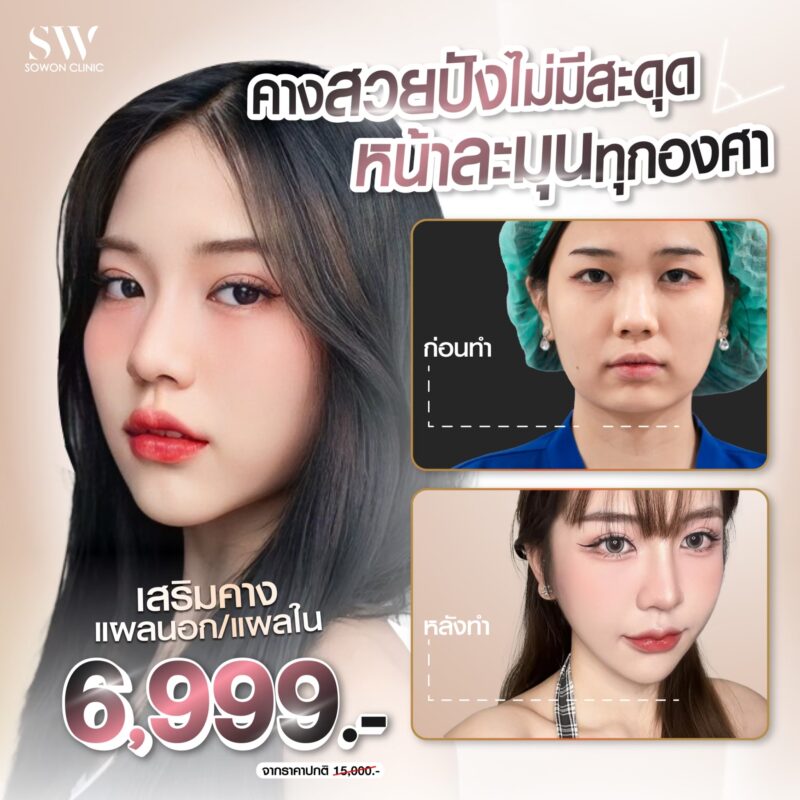 โปรโมชั่นเสริมคาง 6999