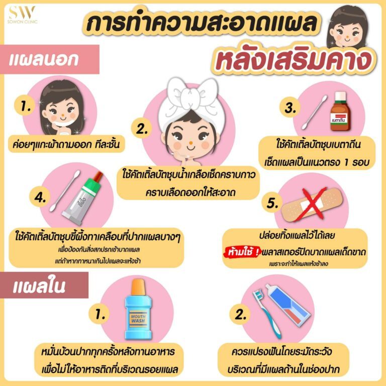 ทำความสะอาดหลังเสริมคาง