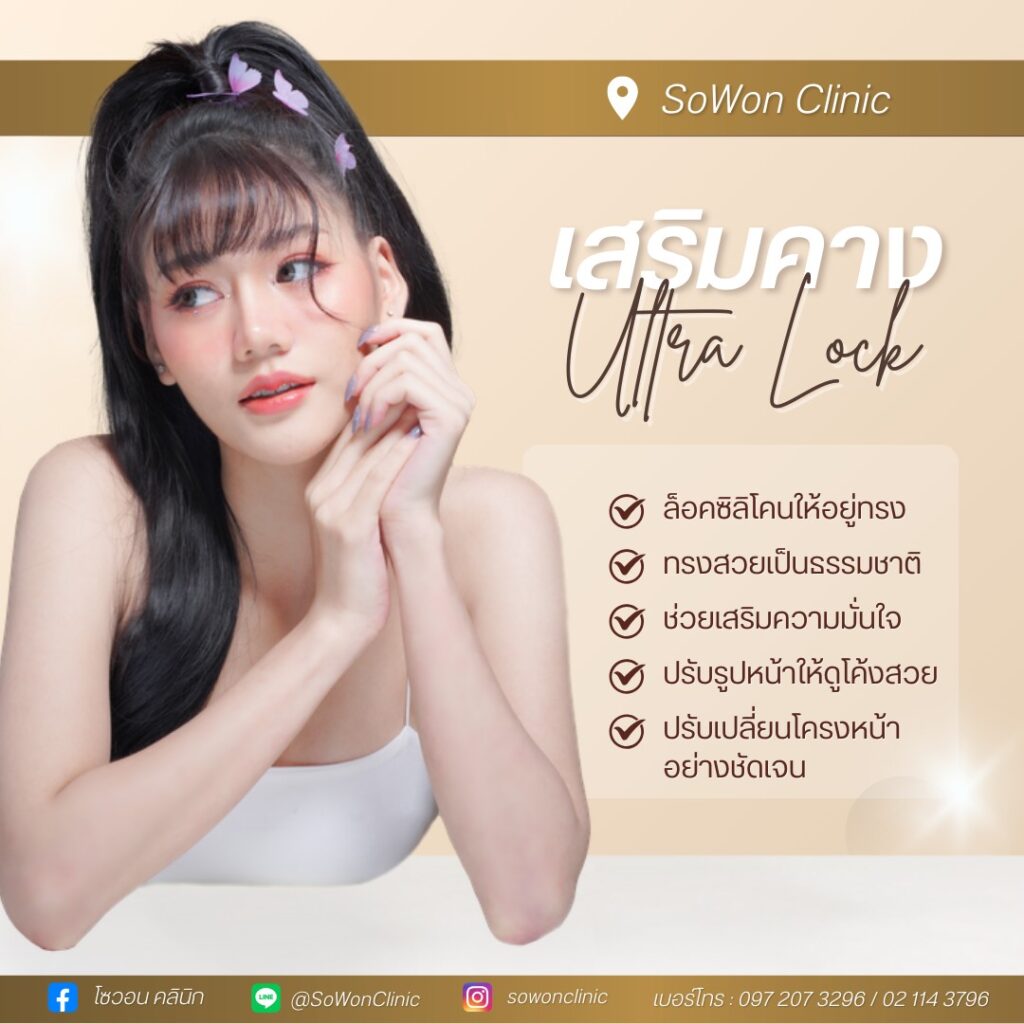 เสริมคางแบบ Ultra Lock