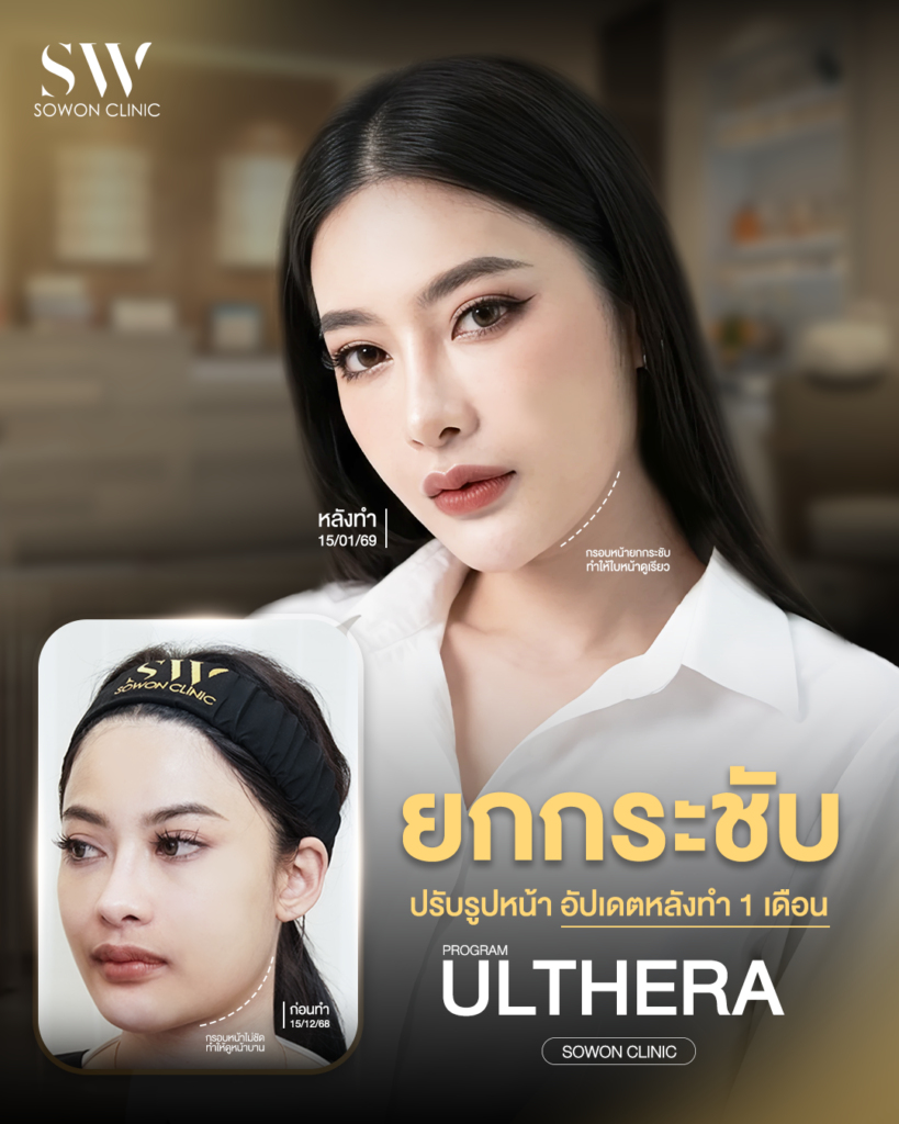 Ulthera