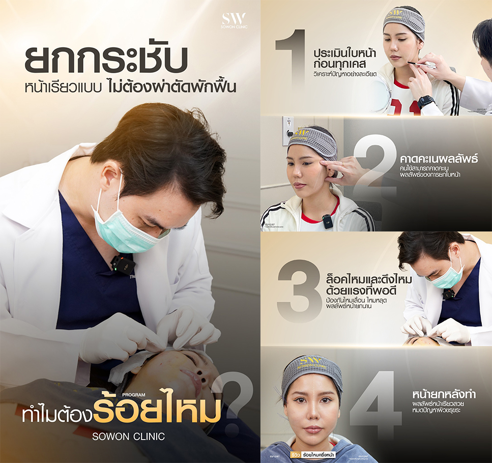 ทำไมต้องร้อยไหม