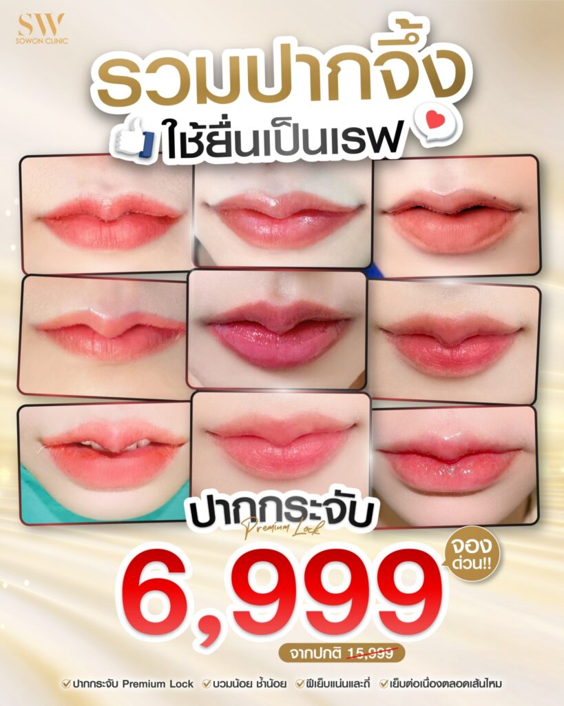 โปรโมชั่นปากกระจับ Sowon Clinic