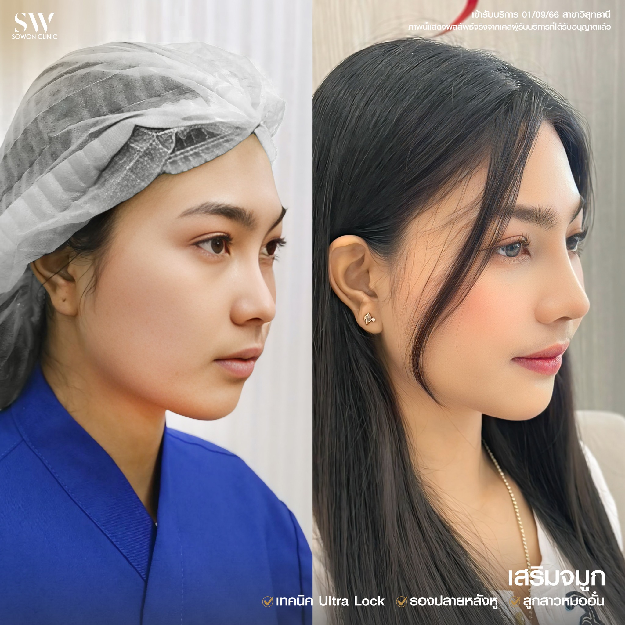 ทรงจมูกสโลปหวาน05