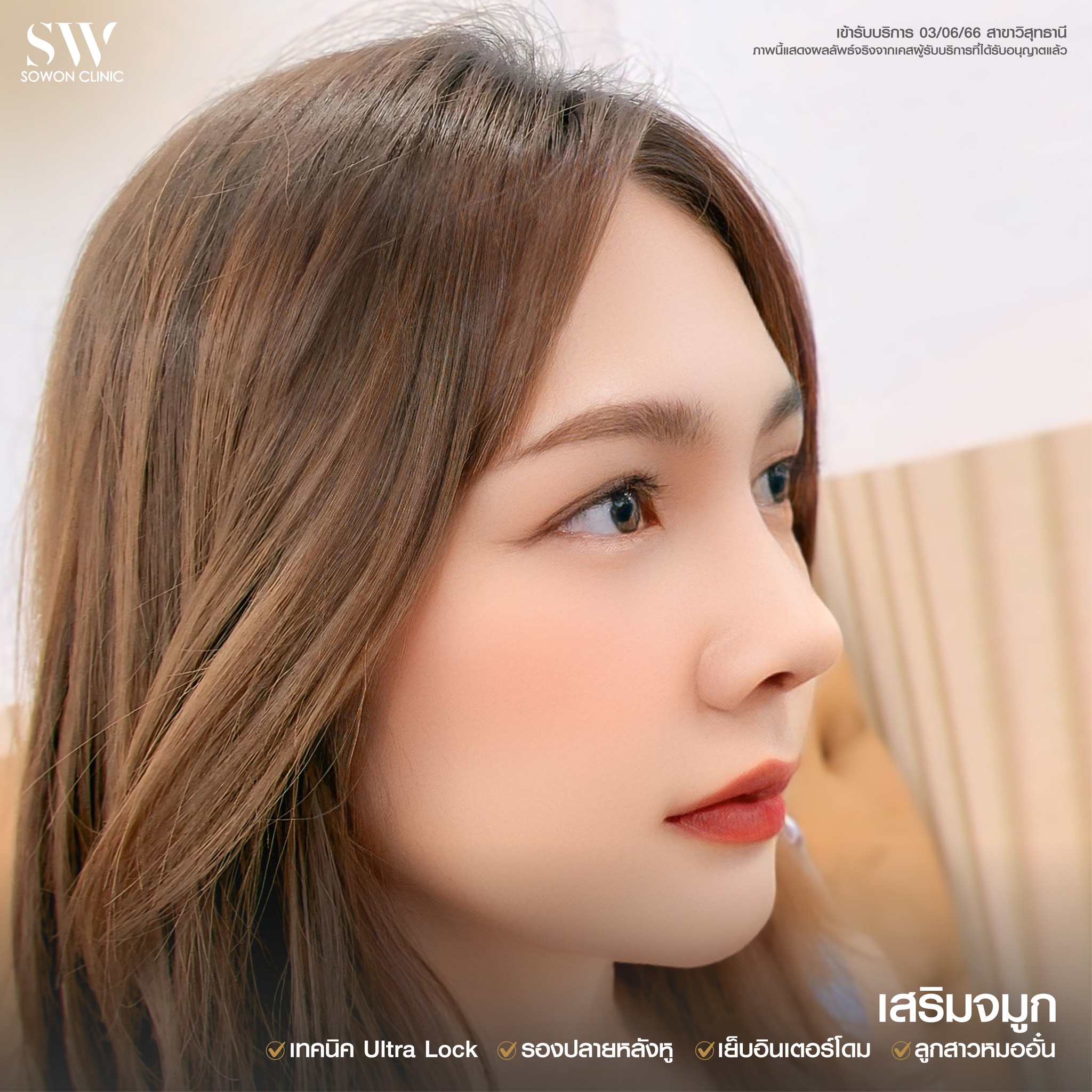 ทรงจมูกสโลปหวาน รีวิว01