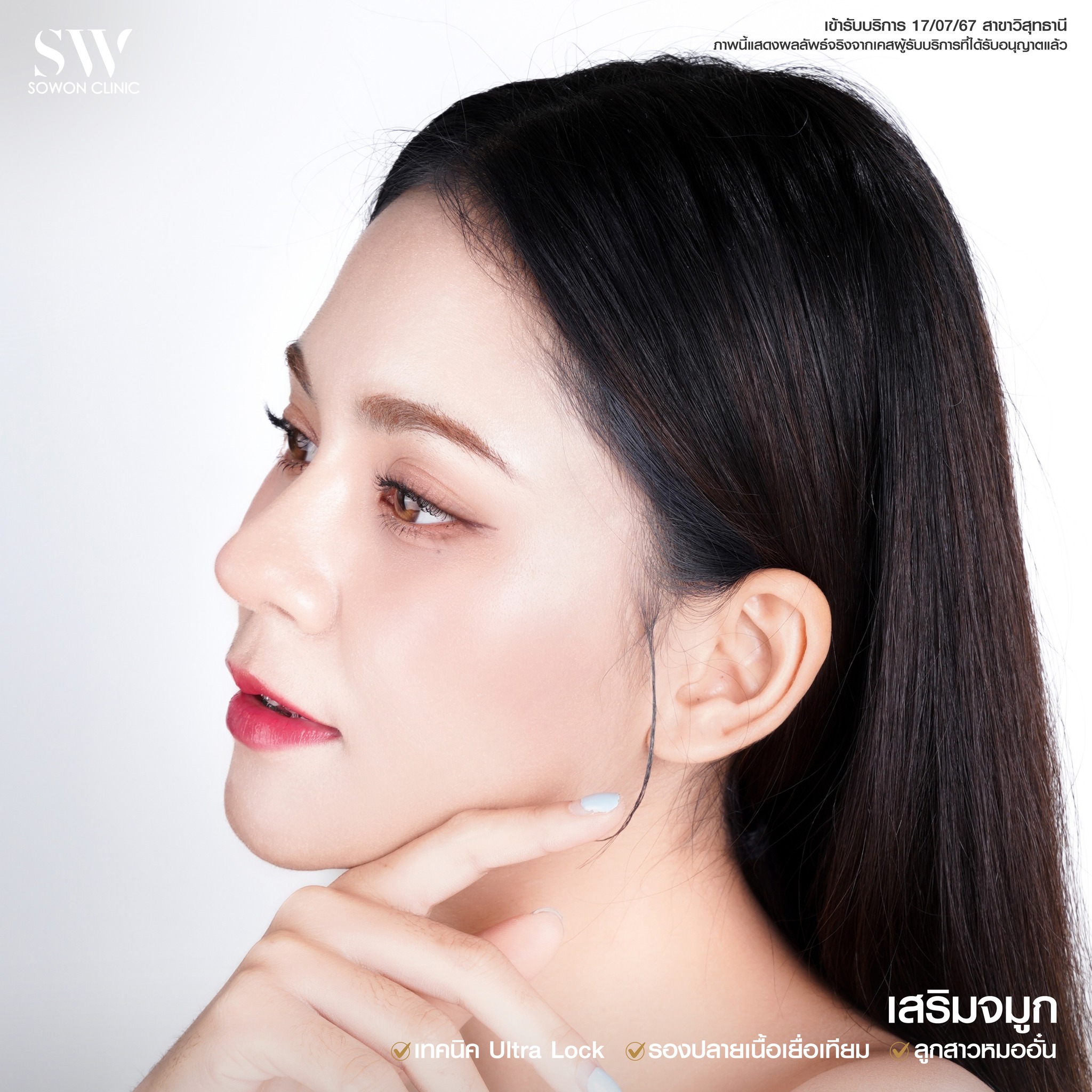 ทรงจมูกสโลปหวาน รีวิว04
