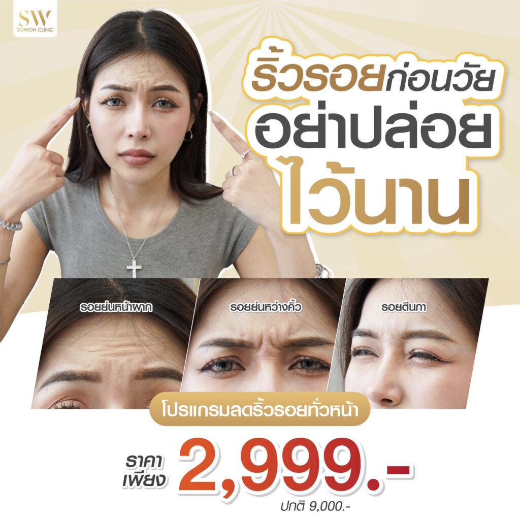 โปรโมชั่นร้อยไหมมิ้นท์ โปรโบริ้วรอย 2999