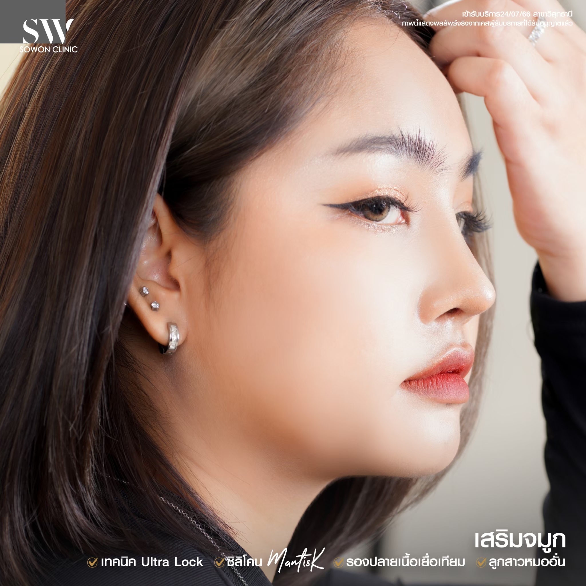 ทรงจมูกสโลปหวาน รีวิว07