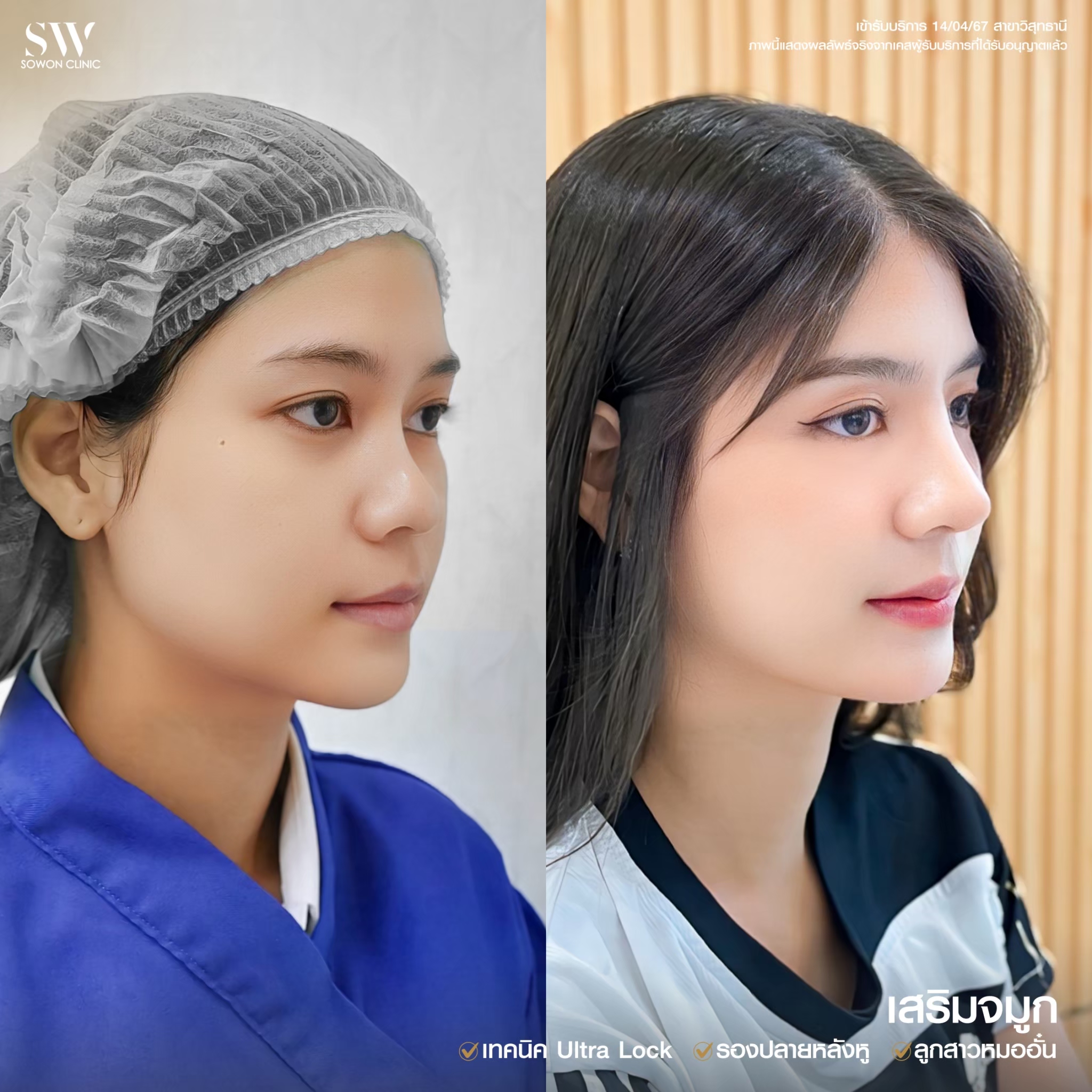 ทรงจมูกสโลปหวาน011