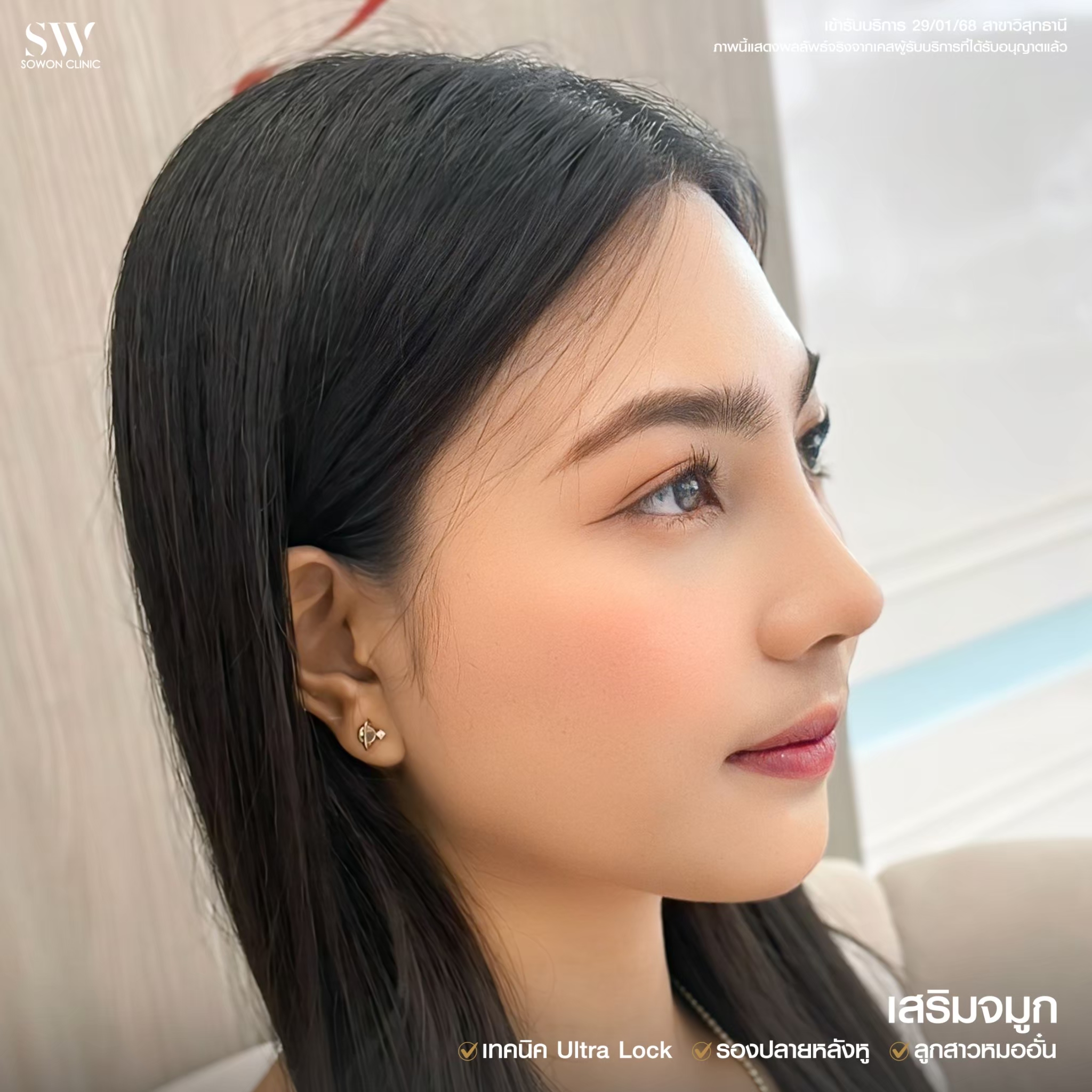 ทรงจมูกสโลปหวาน รีวิว09