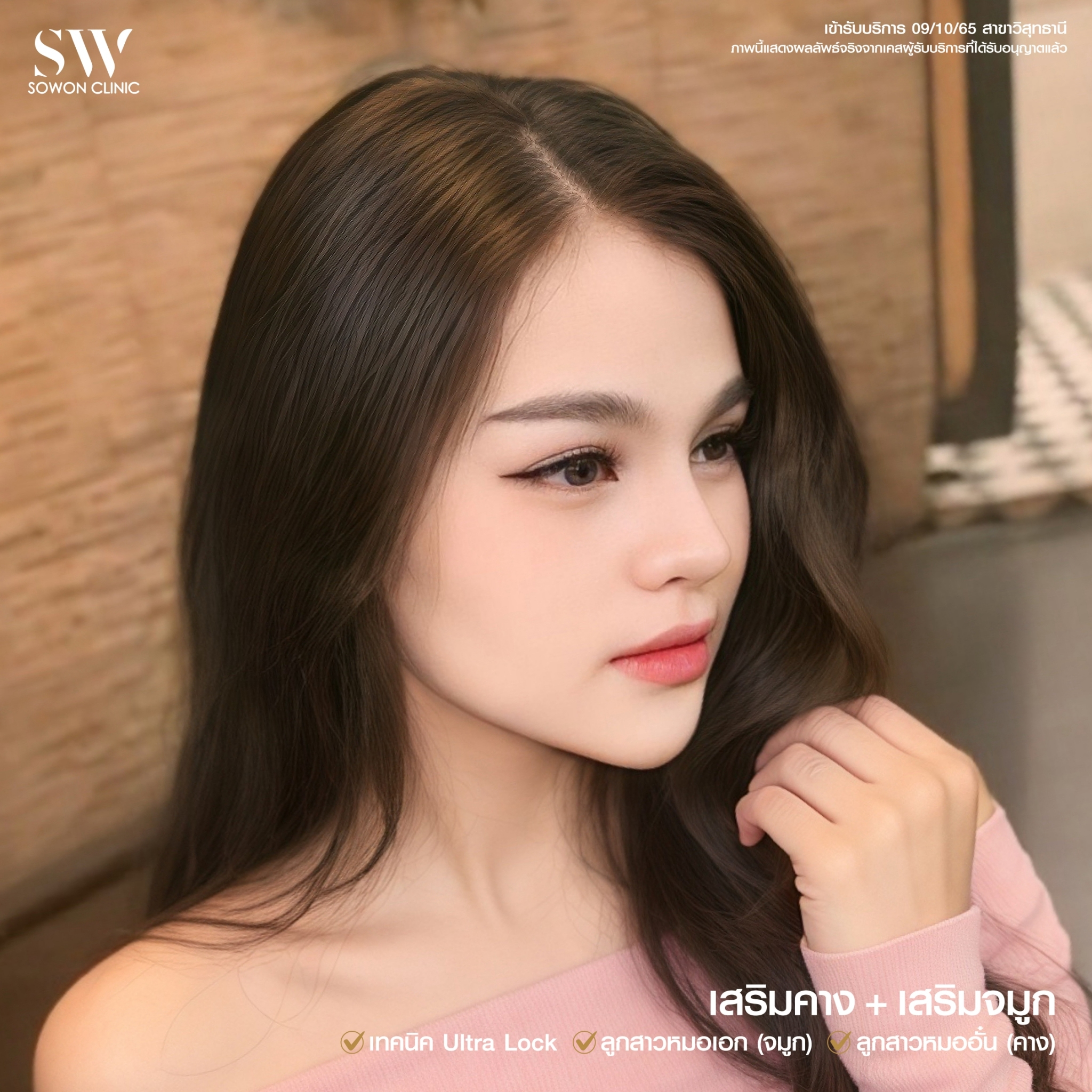 ทรงจมูกสโลปหวาน รีวิว02