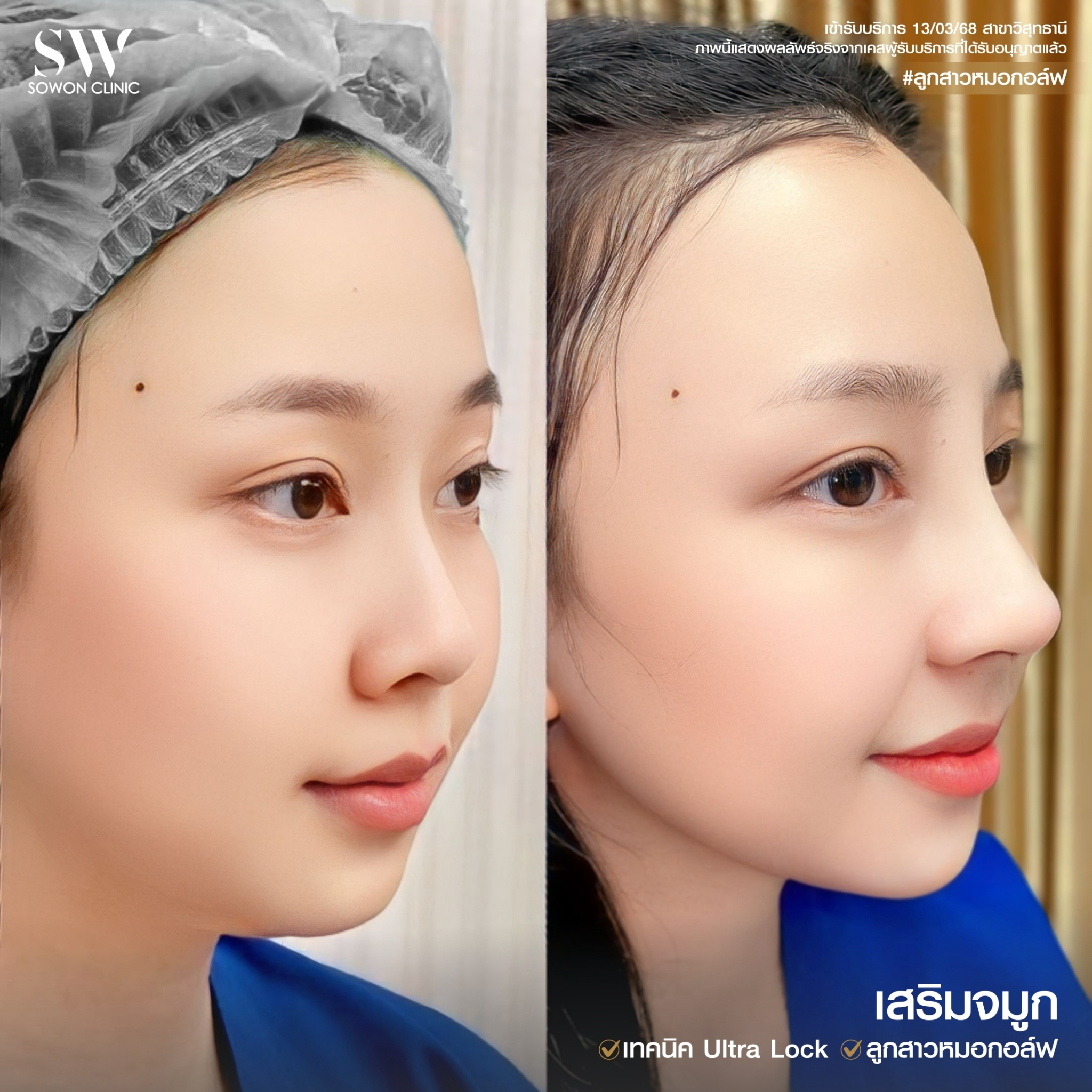 ทรงจมูกสโลปหวาน014