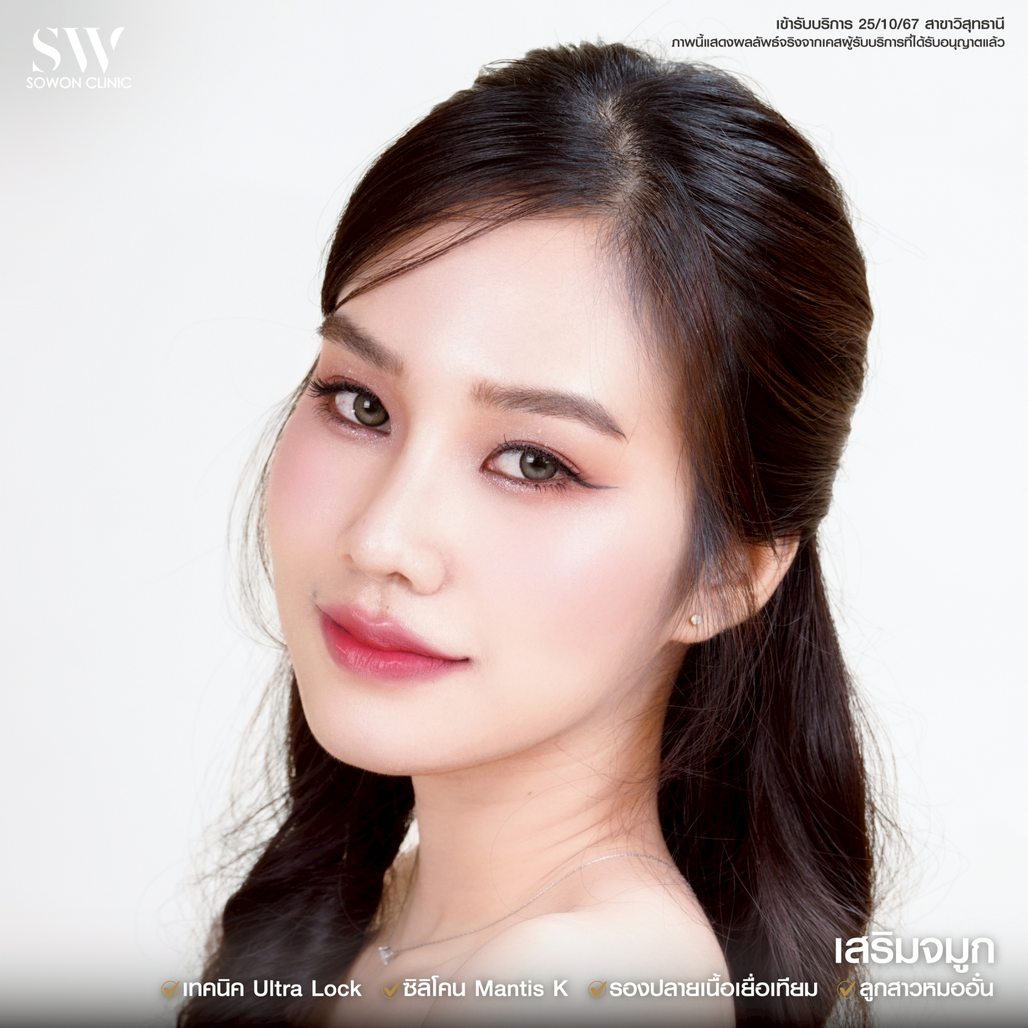 ทรงจมูกสโลปหวาน รีวิว0 3
