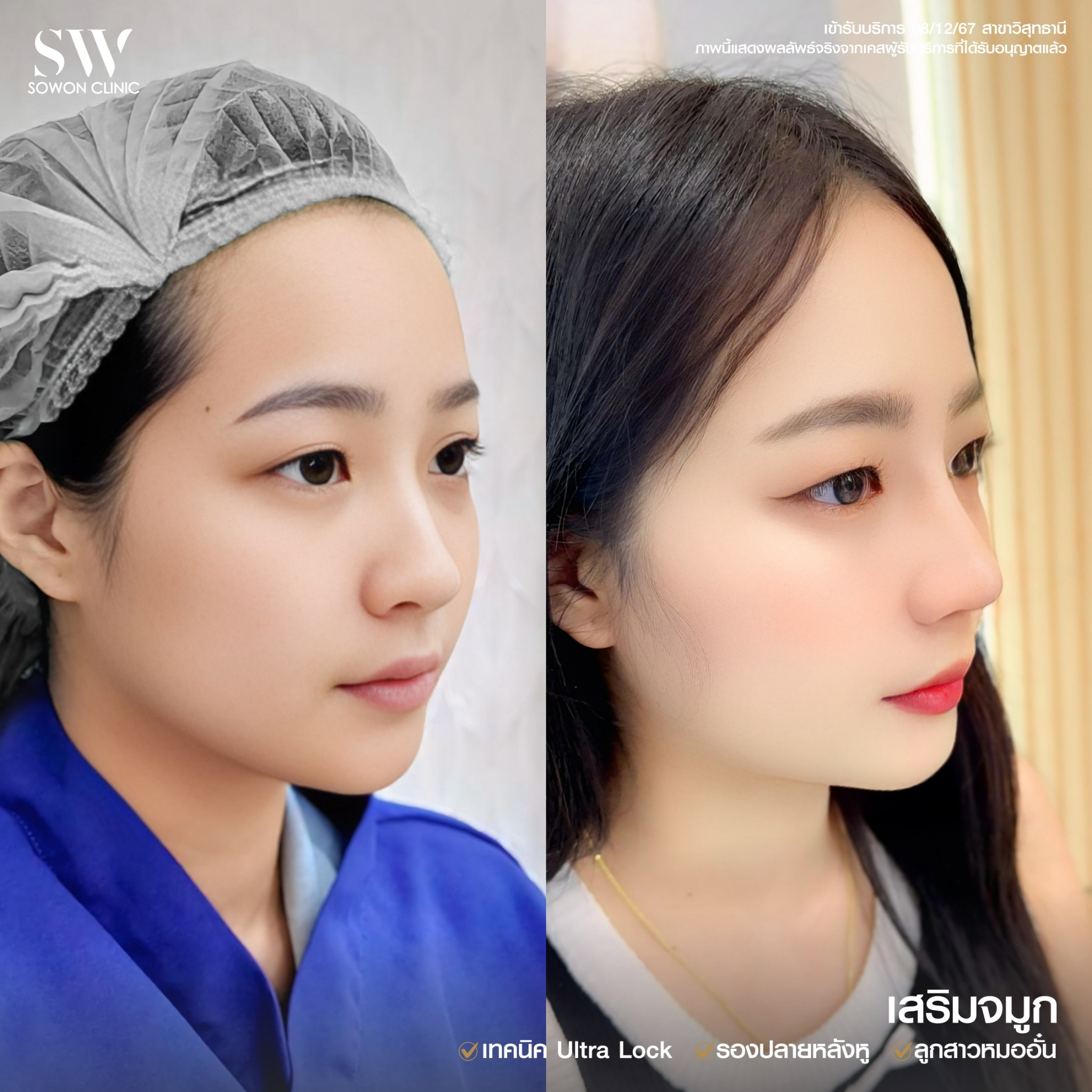 ทรงจมูกสโลปหวาน015