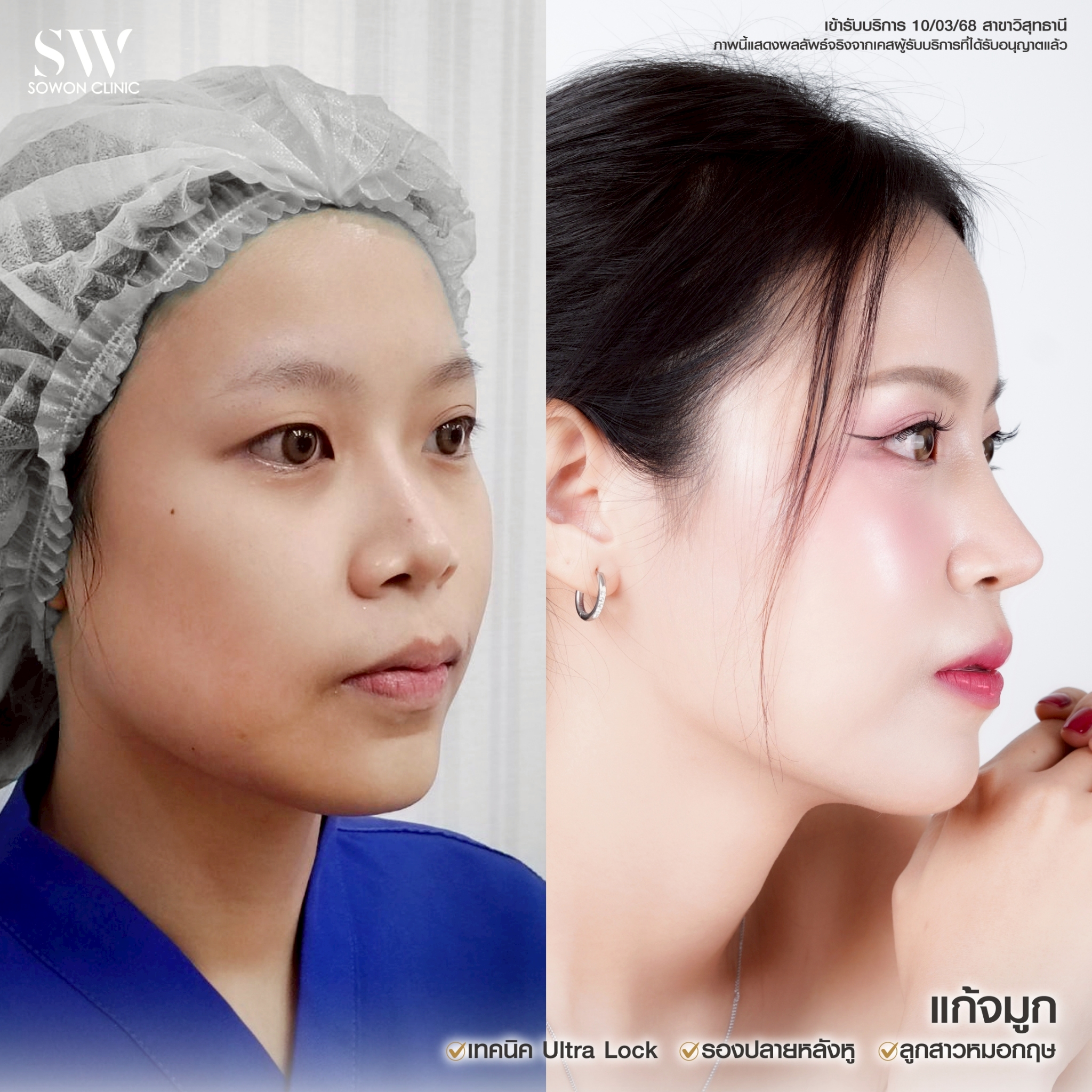 ทรงจมูกสโลปหวาน03