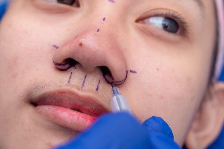 คนไข้ตัดสินใจเสริมจมูก หลังจากได้คำตอบแล้วว่าทำจมูกราคาเท่าไร