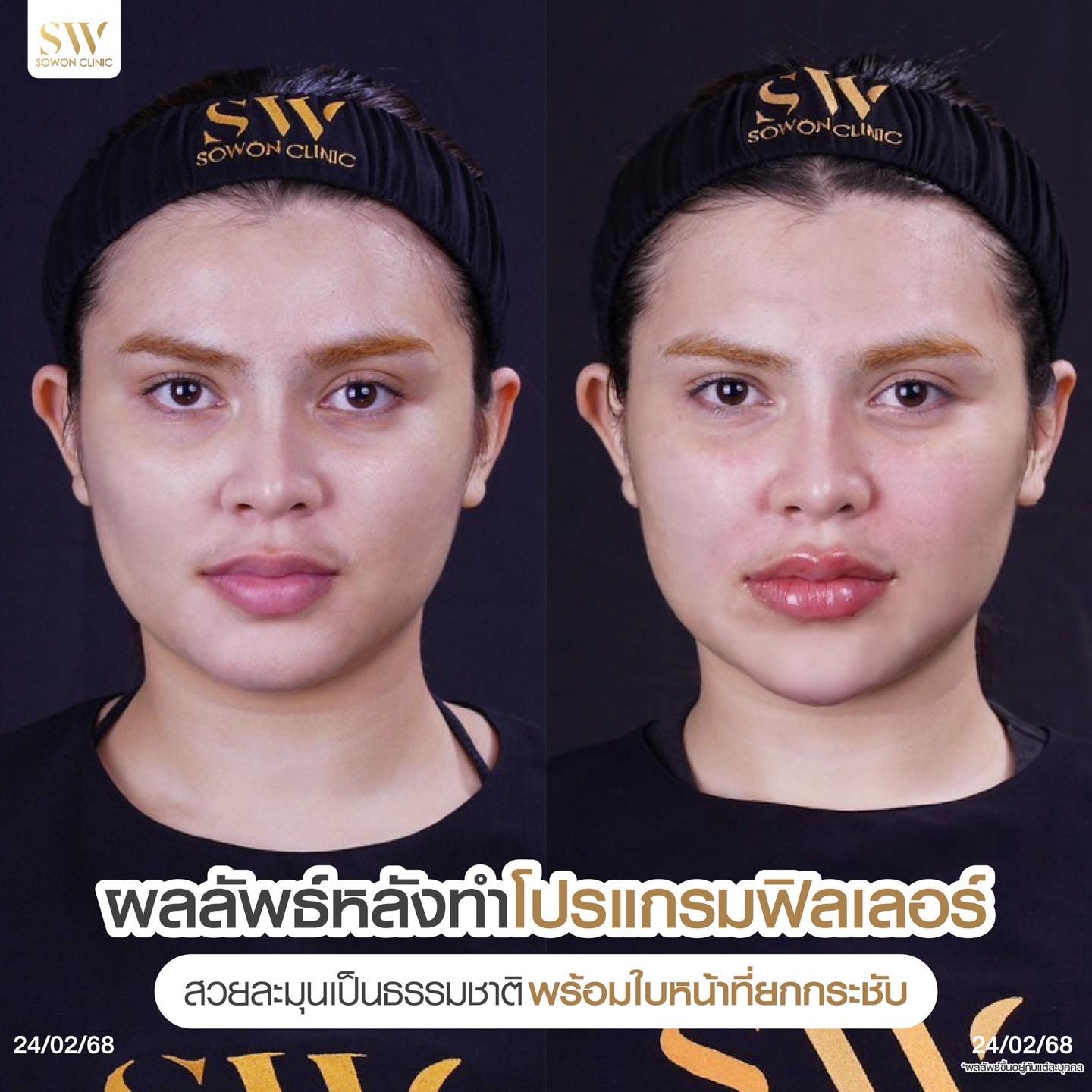 โปรแกรมฟิลเลอร์รีวิว01