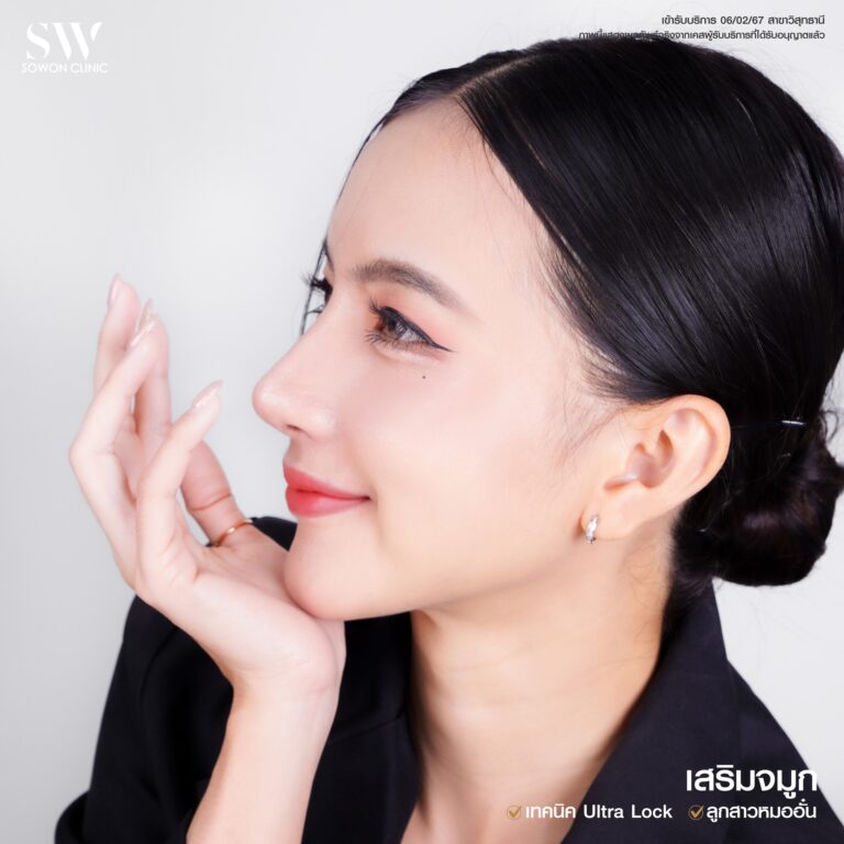 รีวิวเสริมจมูก06