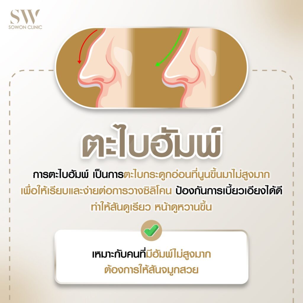 รีวิวเสริมจมูก_ตะไบฮัมพ์