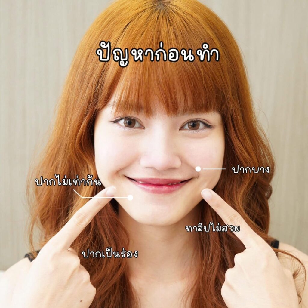 โปรแกรมฟิลเลอร์ปาก ปัญหา