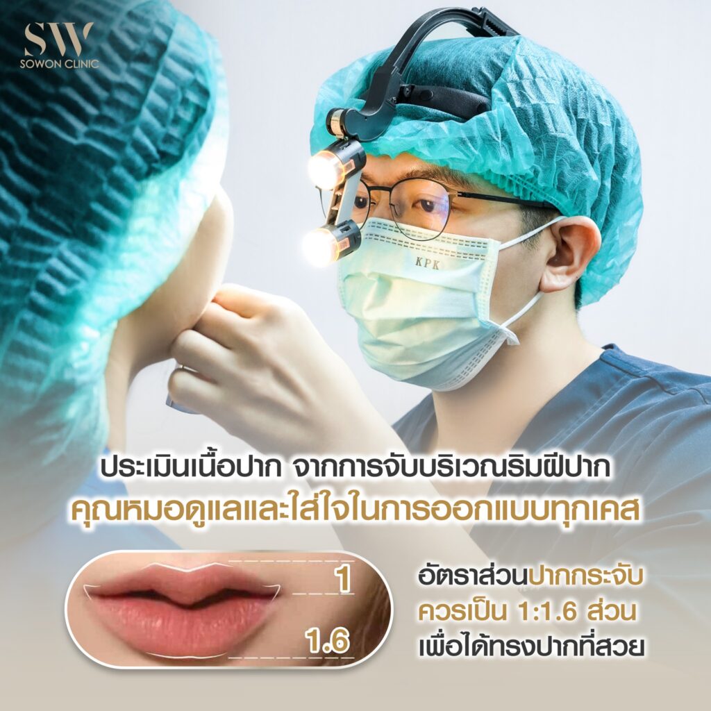 ปากกระจับบน ล่าง