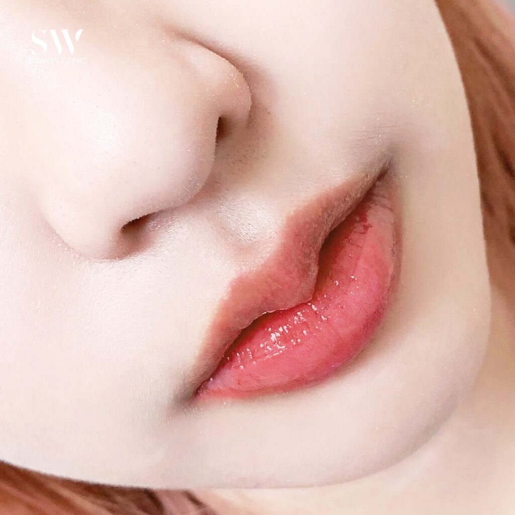 ปากกระจับบน-ล่าง 04