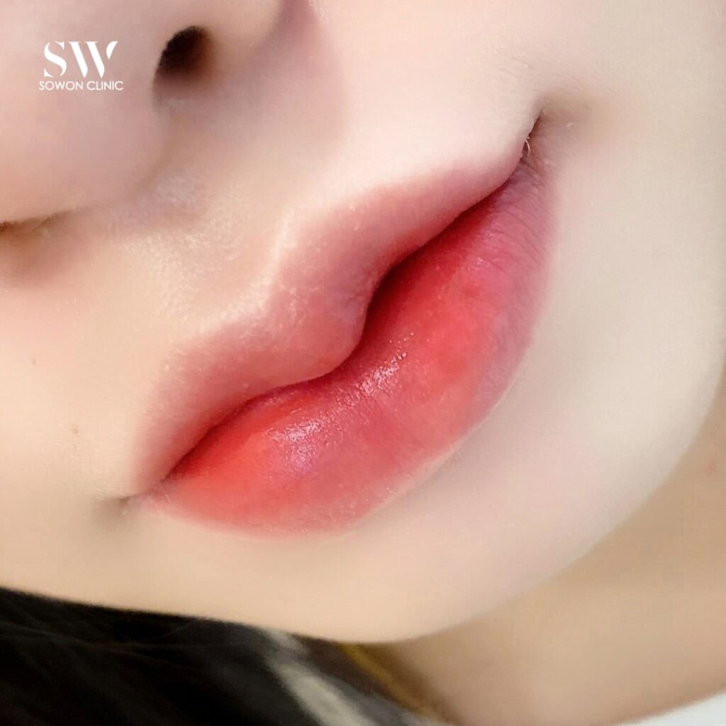ปากกระจับบน-ล่าง 06