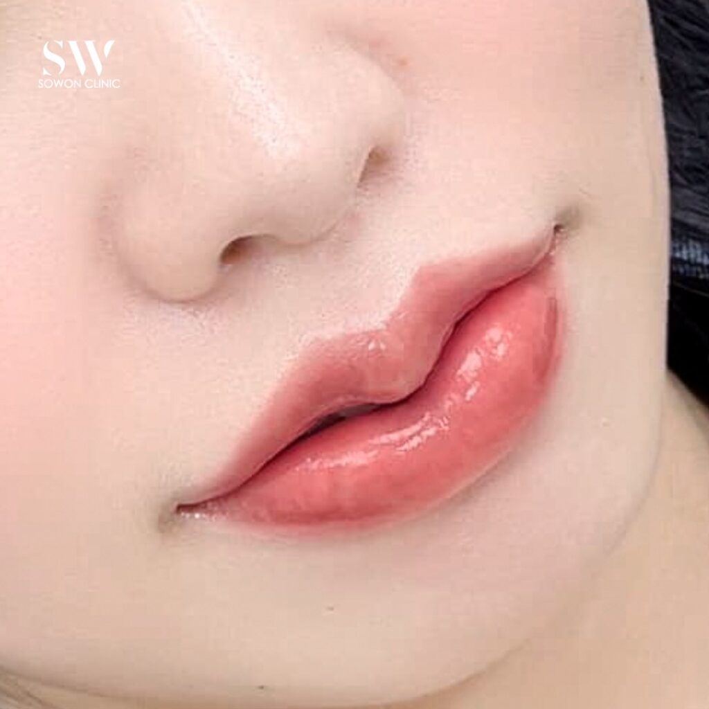 ปากกระจับบน-ล่าง 07