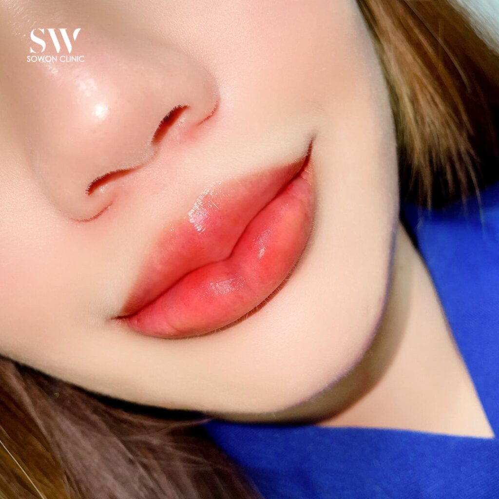 ปากกระจับบน-ล่าง 08