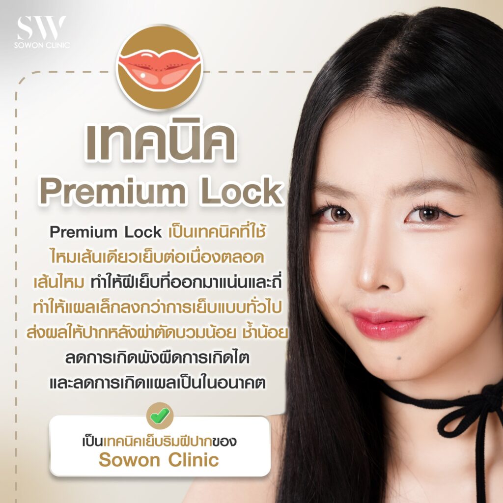ปากกระจับบน-ล่าง เทคนิค