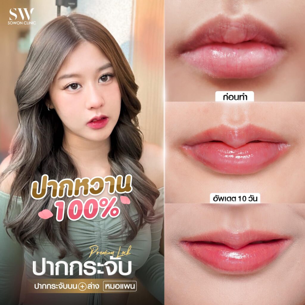 ปากกระจับบนล่าง