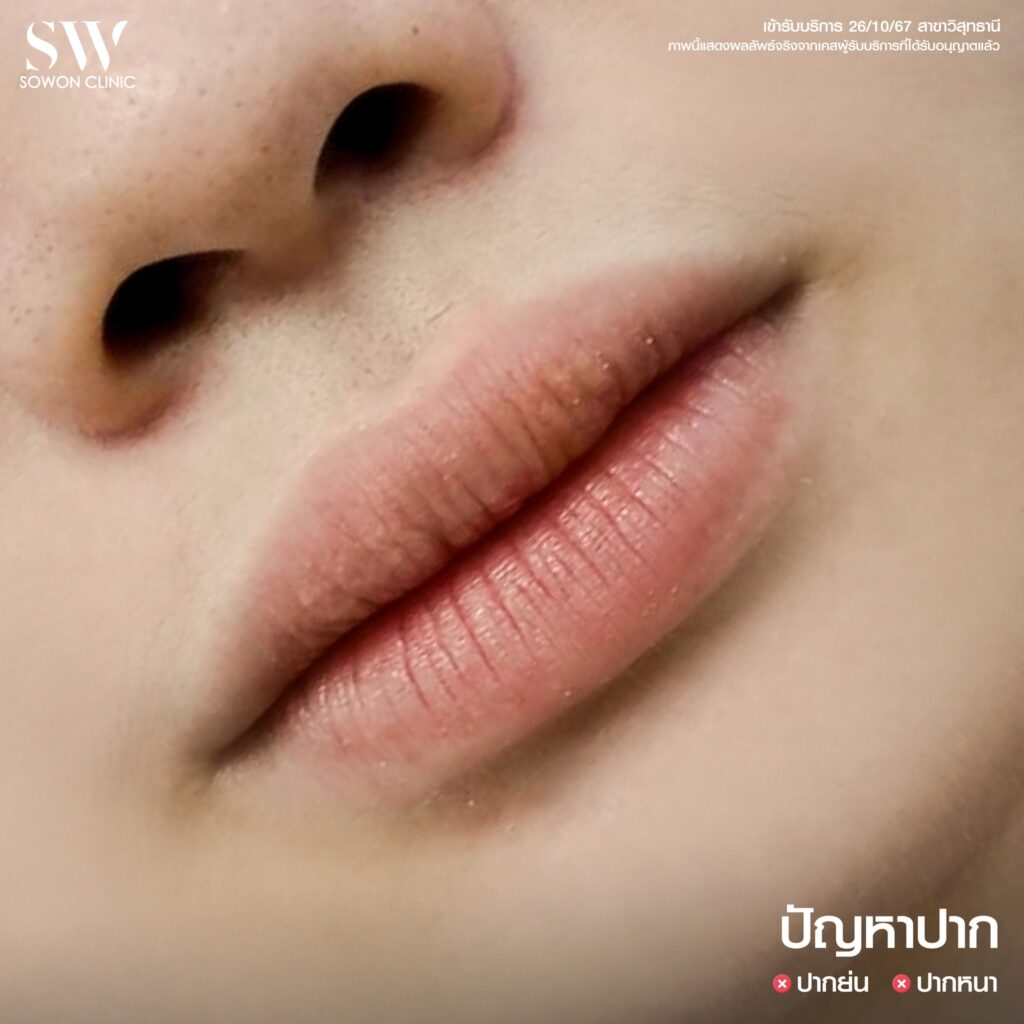 ปัญหาปากกระจับ