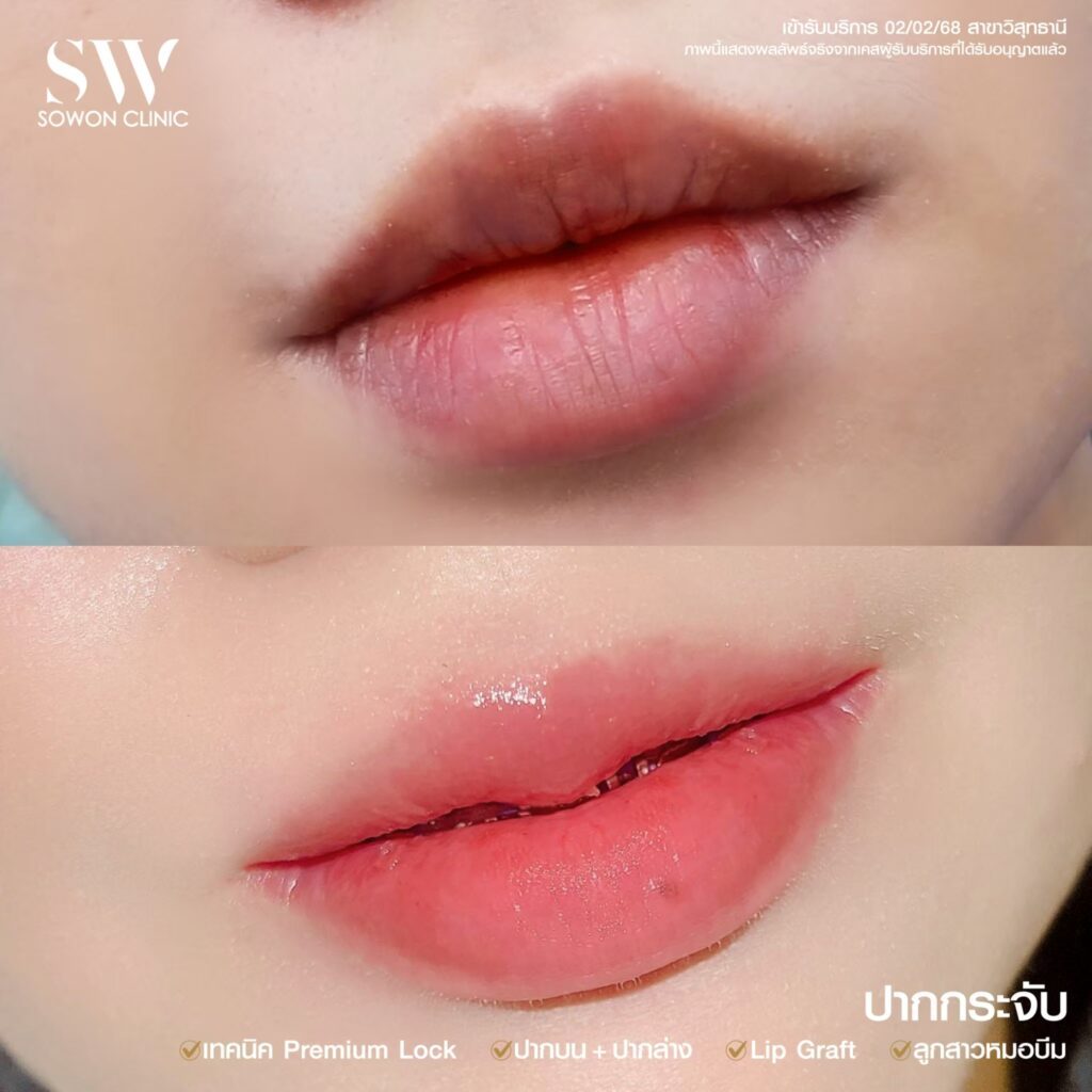รีวิวปากกระจับบน+ล่าง02